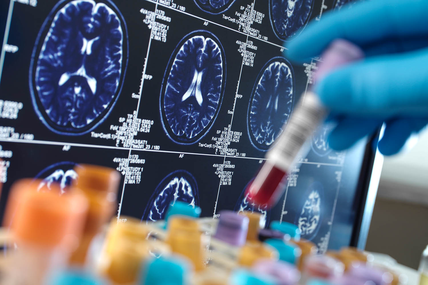 Want a happy life? Avoid medical tests