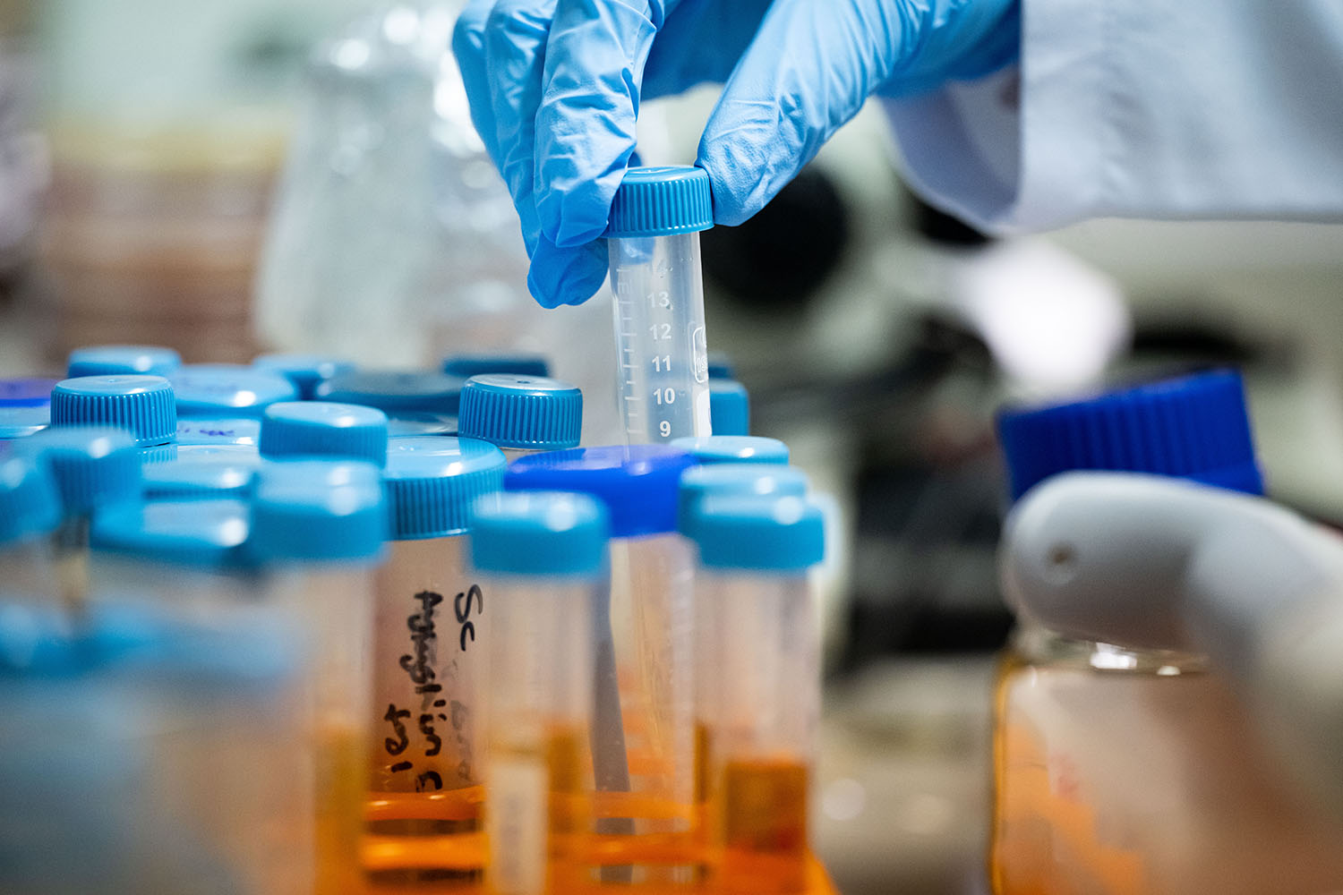 Budget cuts close UK body tackling antimicrobial resistance