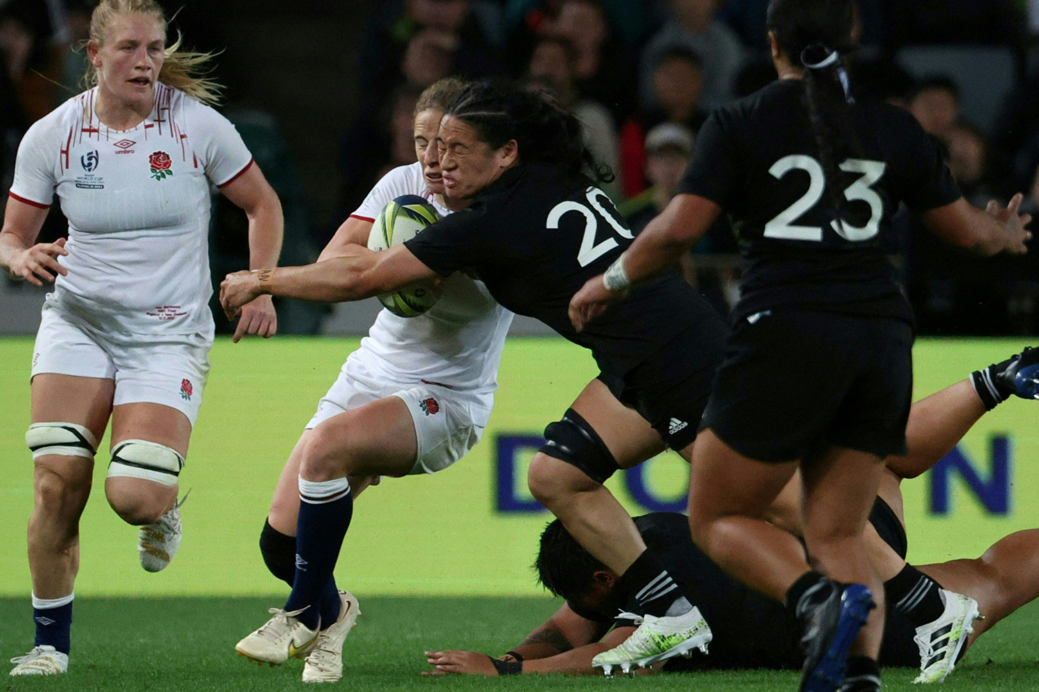 Rugby must step up its game on concussion